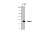 Paxillin Antibody in Western Blot (WB)