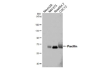 Paxillin Recombinant Rabbit Monoclonal Antibody (HL4818)