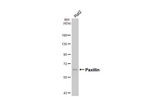 Paxillin Antibody in Western Blot (WB)