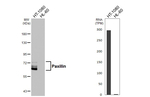 Paxillin Antibody in Western Blot (WB)