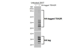 TBXA2R Recombinant Rabbit Monoclonal Antibody (HL4757)