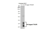 TBXA2R Recombinant Rabbit Monoclonal Antibody (HL4934)