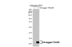 TBXA2R Recombinant Rabbit Monoclonal Antibody (HL4935)