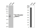 IL13RA2 Recombinant Rabbit Monoclonal Antibody (HL5407)