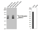 IL13RA2 Recombinant Rabbit Monoclonal Antibody (HL5409)