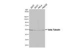 beta Tubulin Recombinant Rabbit Monoclonal Antibody (HL5123)