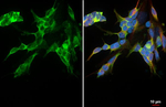 PDGFRA Recombinant Rabbit Monoclonal Antibody (HL5001)