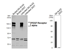 PDGFRA Antibody in Western Blot (WB)
