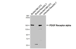 PDGFRA Antibody in Western Blot (WB)