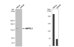 SHIP2 Recombinant Rabbit Monoclonal Antibody (HL5150)