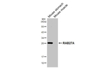 RAB27A Recombinant Rabbit Monoclonal Antibody (HL4759)