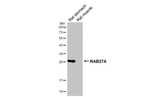 RAB27A Antibody in Western Blot (WB)