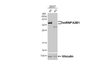 hnRNP A2B1 Recombinant Rabbit Monoclonal Antibody (HL5249)
