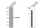 CYFIP2 Antibody in Western Blot (WB)
