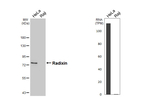 Radixin Recombinant Rabbit Monoclonal Antibody (HL5402)