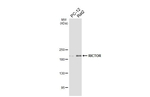 RICTOR Antibody in Western Blot (WB)