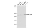 RICTOR Recombinant Rabbit Monoclonal Antibody (HL5325)