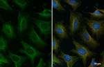 Alix Recombinant Rabbit Monoclonal Antibody (HL4841)