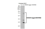 BDKRB2 Antibody in Western Blot (WB)