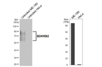 BDKRB2 Recombinant Rabbit Monoclonal Antibody (HL5131)