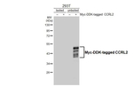 CCRL2 Recombinant Rabbit Monoclonal Antibody (HL4222)