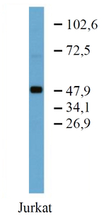 TRK fused gene Monoclonal Antibody (TFG-03)