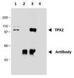 TPX2 Antibody in Immunoprecipitation (IP)