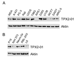 TPX2 Antibody in Western Blot (WB)