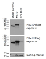 PPM1D Monoclonal Antibody (7E11/C5)