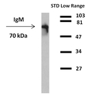 Human IgM Antibody in Western Blot (WB)