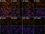 N6-Methyladenosine (m6A) Antibody in Immunocytochemistry (ICC/IF)