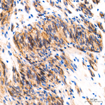 c-Kit Antibody in Immunohistochemistry (Paraffin) (IHC (P))
