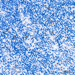 c-Kit Antibody in Immunohistochemistry (Paraffin) (IHC (P))