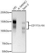 c-Kit Antibody in Western Blot (WB)