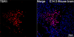 TBR1 Recombinant Rabbit Monoclonal Antibody (7I8C4)