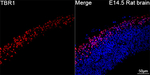 TBR1 Antibody in Immunohistochemistry (Paraffin) (IHC (P))