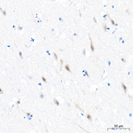 TBR1 Antibody in Immunohistochemistry (Paraffin) (IHC (P))