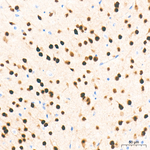 TBR1 Antibody in Immunohistochemistry (Paraffin) (IHC (P))