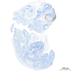 TBR1 Antibody in Immunohistochemistry (Paraffin) (IHC (P))