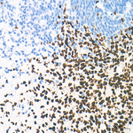 TBR1 Antibody in Immunohistochemistry (Paraffin) (IHC (P))