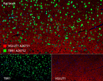 TBR1 Antibody in Multiplex Immunohistochemistry (mIHC)