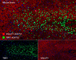 TBR1 Antibody in Multiplex Immunohistochemistry (mIHC)