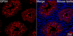 GPX4 Recombinant Rabbit Monoclonal Antibody (5M2E7)