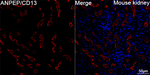 CD13 Recombinant Mouse Monoclonal Antibody (1J2N3)