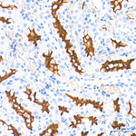 CD13 Antibody in Immunohistochemistry (Paraffin) (IHC (P))