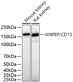 CD13 Antibody in Western Blot (WB)