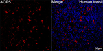 Tartrate Resistant Acid Phosphatase Recombinant Rabbit Monoclonal Antibody (8O4F5)