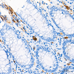Tartrate Resistant Acid Phosphatase Antibody in Immunohistochemistry (Paraffin) (IHC (P))