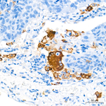 Tartrate Resistant Acid Phosphatase Antibody in Immunohistochemistry (Paraffin) (IHC (P))