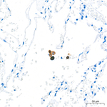 Tartrate Resistant Acid Phosphatase Antibody in Immunohistochemistry (Paraffin) (IHC (P))